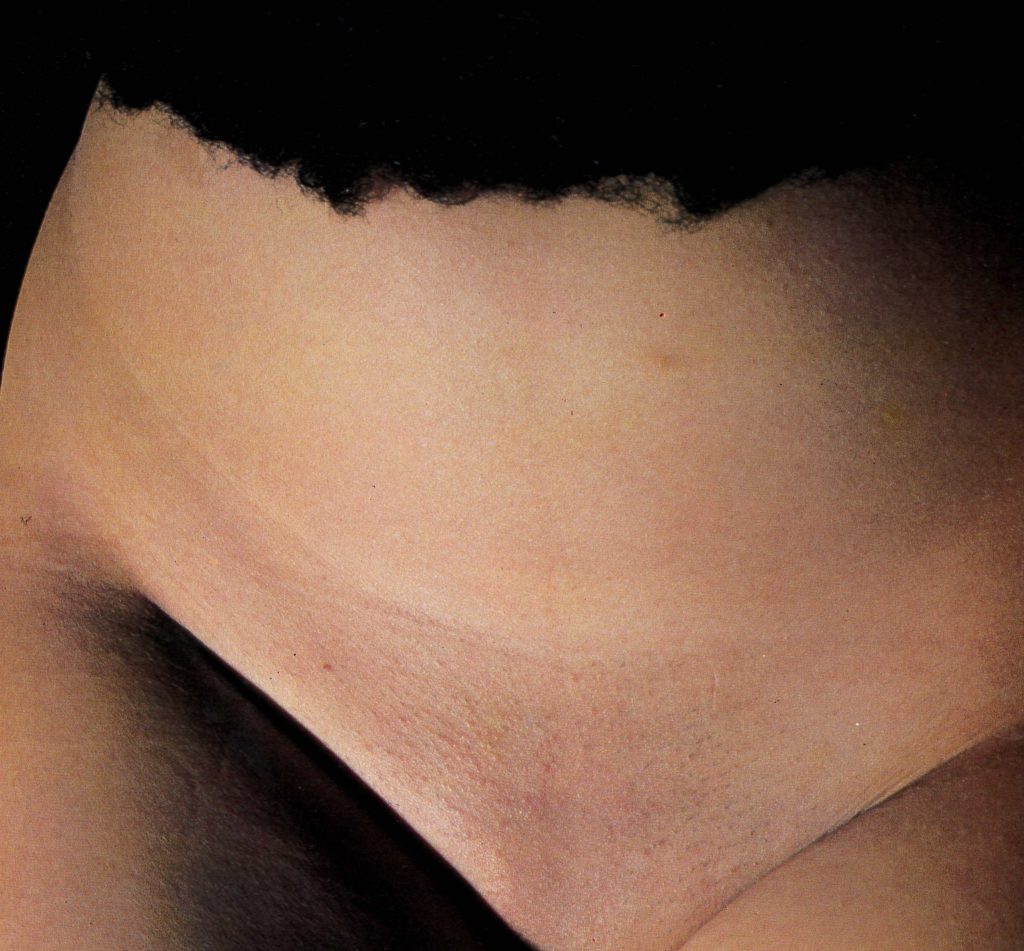 異物挿入調教された人妻のSM画像。